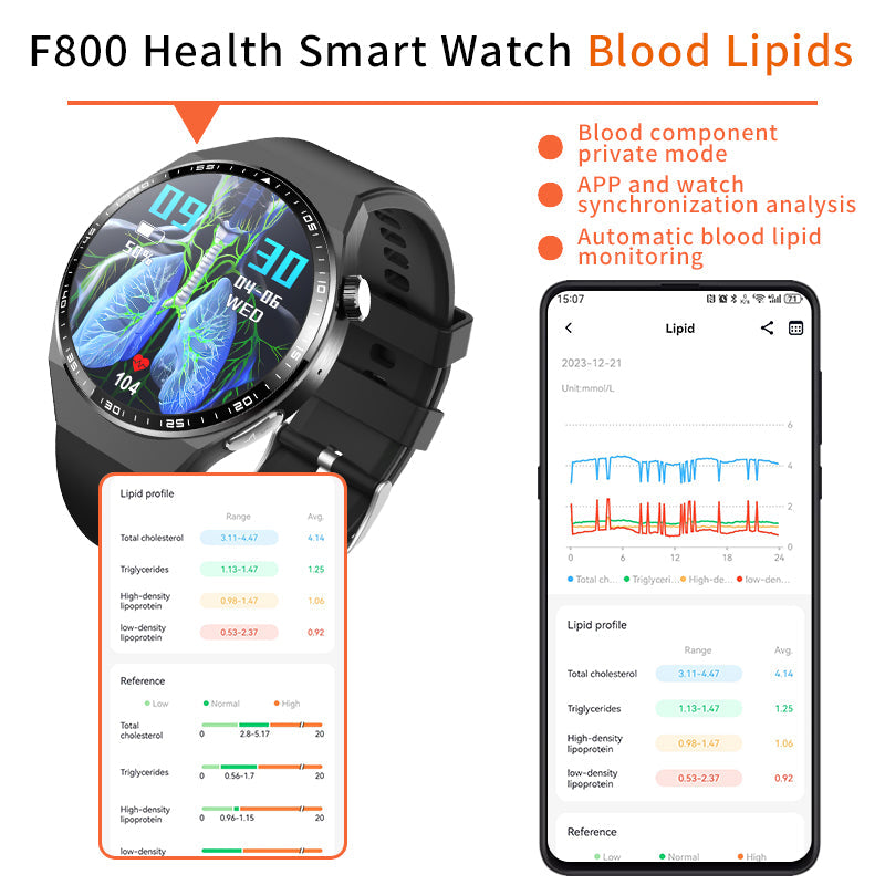 2025 Sport & Wellness Smartwatch for Women & Men | ECG + PPG | AdLoSi